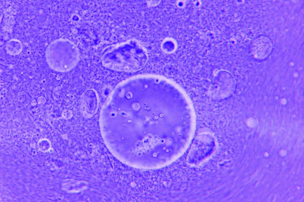 ocjene embrija, IVF postupak, Miraculum ivf