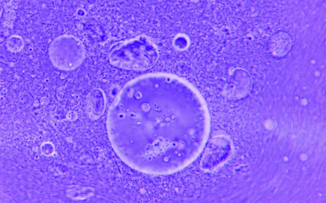 Što znače ocjene embrija 4AA, 5AA ili 3BB? Vodič kroz grading embrija u IVF-u